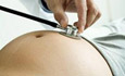 超声波检查 孕中期关键