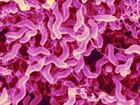 幽门螺杆菌的症状是什么