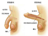 小编教你判断男人阴茎勃起程度