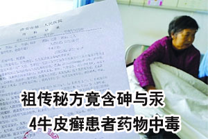 祖传秘方竟含砷与汞 4牛皮癣患者药物中毒