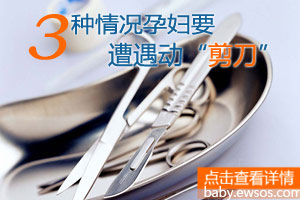 分娩过程三情况要动“剪刀”