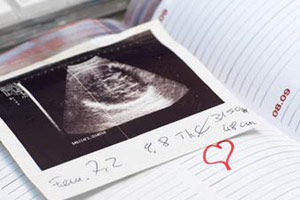 科学判定胎儿性别的方式