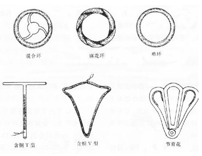 女性上环全过程