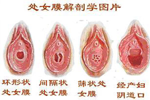 处女膜能用肉眼看到吗？