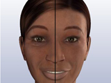 3D图解双眼皮手术全过程