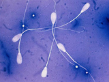 孕前老公提高精子质量的窍门