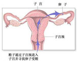全面目击女人避孕的全过程