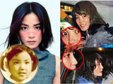 盘点整容失败自杀的明星们