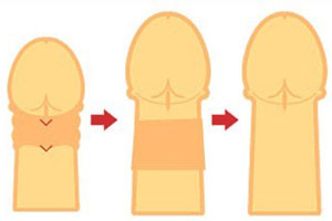 男人必看阴茎短小健身操