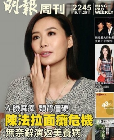 毁颜不带血！前仆后继的面瘫明星