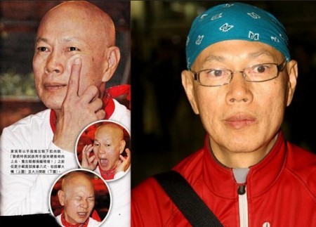 毁颜不带血！前仆后继的面瘫明星