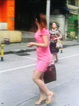 男子做包皮手术致下体被烤熟 被迫切除(图) 男子做包皮手术致下体被烤熟 被迫切除(图)