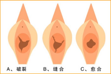 图解处女膜破裂的全过程！