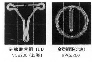 爆！女性上环全过程(多图）