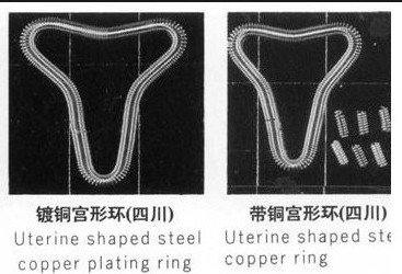 爆！女性上环全过程(多图）