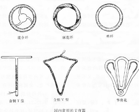 爆！女性上环全过程(多图）