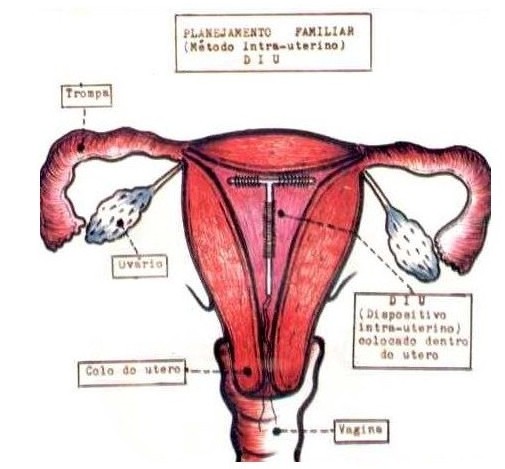 爆！女性上环全过程(多图）