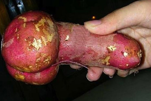 14种日常保养 帮男人强阴茎