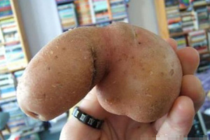 保护男人命根健康需注意禁忌