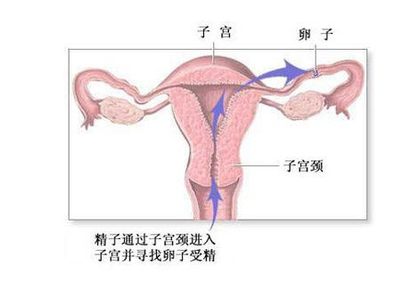 女人怎样避孕