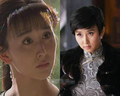 明星整容变僵尸脸笑比哭难看
