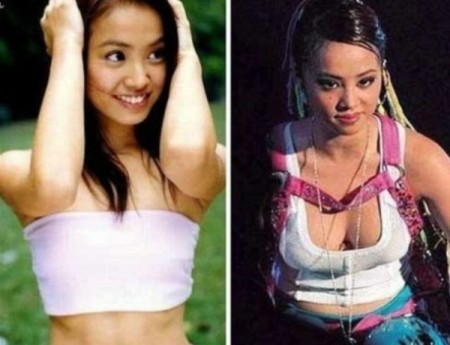 女星真假胸器探秘 丰胸前后对比照大曝 女星真假胸器探秘 丰胸前后对比照大曝
