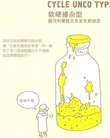 你的便便正常吗？ 细数便便的几种形态