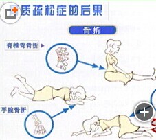 骨质疏松症的危害是什么? 骨质疏松症的危害是什么?