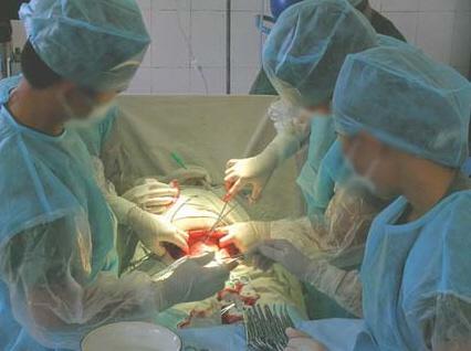 图解剖腹产手术全过程图解剖腹产手术全过程