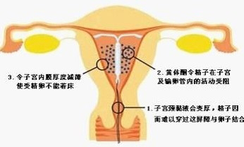 高清图解上环的全过程高清图解上环的全过程