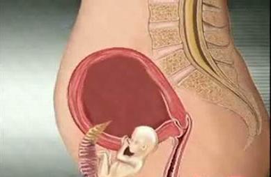 宫外孕的原因、症状及相关知识宫外孕的原因、症状及相关知识