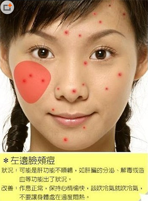 从痘痘位置看你的健康讯息从痘痘位置看你的健康讯息