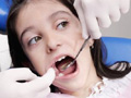 牙周炎临床表现及护理五要点