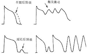 心率失常