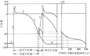 心率失常图3