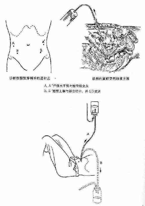 腹部创伤